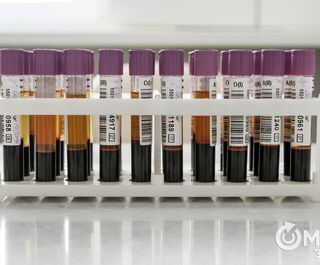В Омске начато тестирование упрощённой системы сдачи анализа на антитела